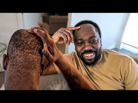 DuB Reveals His Hairline ....