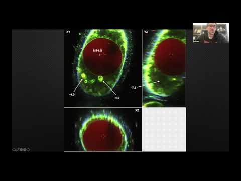 Investigating Thiomargarita's metabolism using microscopy.