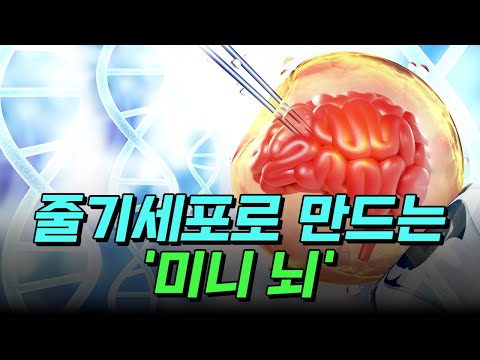 [핫클립] 줄기세포로 만드는 '미니 뇌' / YTN 사이언스