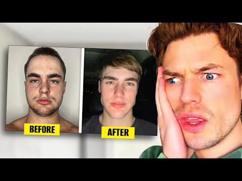 Average Guy 30 Day Looksmaxxing Transformation (Detailed Analysis)