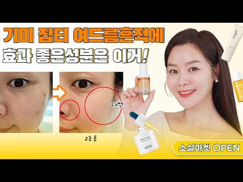 30대 이상‼️기미,잡티,여드름흔적 없애는 방법으로 찐 효과본 성분은? OOO | 소살마켓 07 아떼