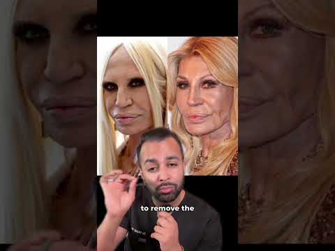 Shocking Donatella Versace Glow-Up - Dr. Somji’s Expert Reaction!