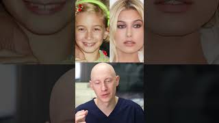 Hailey Bieber had a Nose Job? Plastic Surgeon Reacts