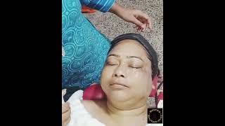 High pigmentation|melasma treatment |ozone therapy|Lotus preservita facial for anti-aging