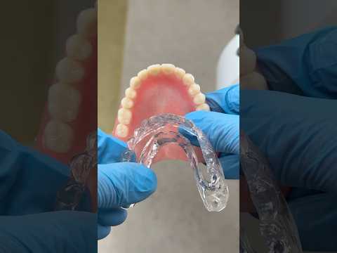 Immediate Denture with a Clear Surgical Stent #lsk121shorts #dentist #teeth