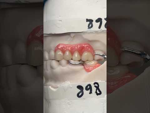 Upper and Lower Metal Try-Ins #lsk121shorts #dentist #teeth