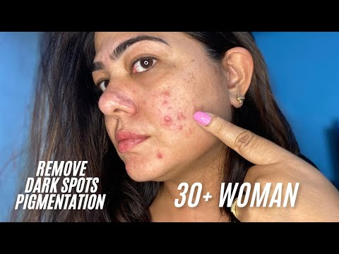 How to reduce pigmentation and dark spots for women over 30 | Kojic Acid skincare Regimen |