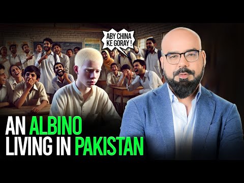 An Albino Living In Pakistan | Junaid Akram Clips