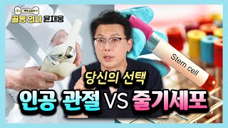 무릎 아플 때 인공 관절 수술이냐? 줄기세포 시술이냐? 딱 정해드립니다! - 골통 의사 윤재웅 #03 줄기세포 무릎치료