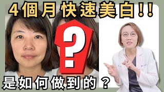 美白非常難！堅持四個月，白到令人驚艷！想要美白？就看這集！