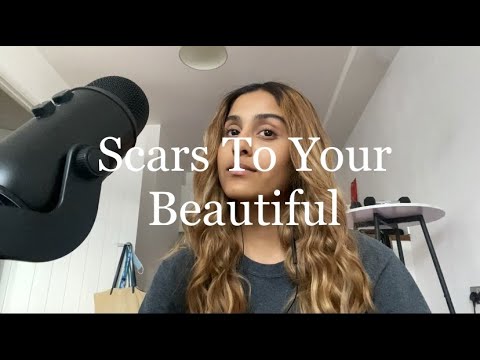 Alessia Cara - Scars To Your Beautiful (cover)