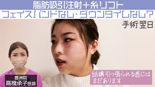 【小顔】脂肪吸引注射＋糸リフトのダウンタイムレポート！#shorts