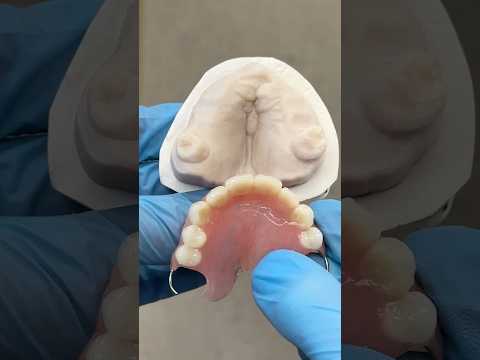 Clasping to the remaining back Molars #lsk121shorts #dentist #teeth