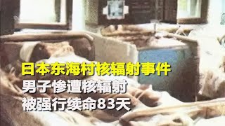 日本东海村核辐射事件，男子惨遭核辐射，被强行续命83天