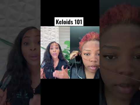 Keloids 101