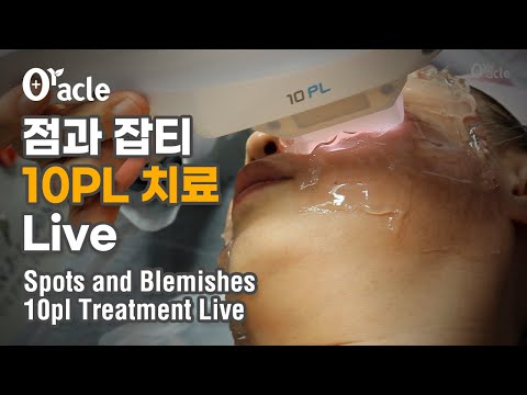 점과 잡티 10pl 치료 라이브 (Spots and Blemishes 10pl Treatment Live)