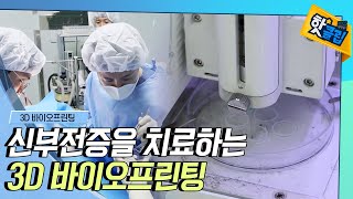 [핫클립] 신부전증을 치료하는 3D 바이오프린팅 기술  / YTN 사이언스