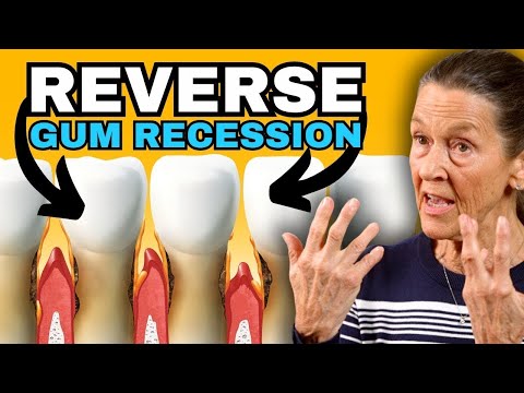 New & Easy way to REGROW Receding Gums at Home in 2024