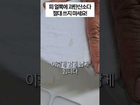 오래된 피 얼룩 제거하는 법. 과탄산소다 먼저 절대 쓰지 마세요!