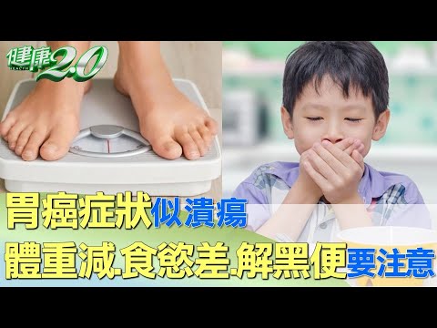 胃癌症狀似潰瘍 體重減.食慾差.解黑便要注意 健康2.0 @tvbshealth20