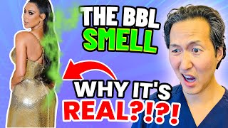 Plastic Surgeon Reacts to the BBL SMELL: Why BBL's Stink!