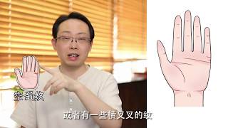 手相看你早婚还是晚婚？Will You Have a Late Marriage? Check Your Palm