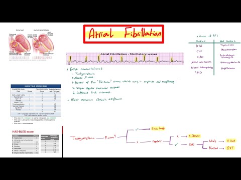 Atrial Fibrillation