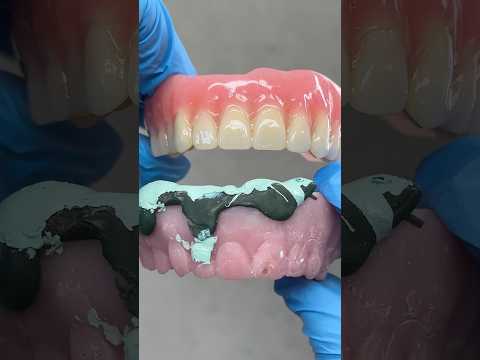 From Impression Prototype to the final Denture #lsk121shorts #dentist #teeth