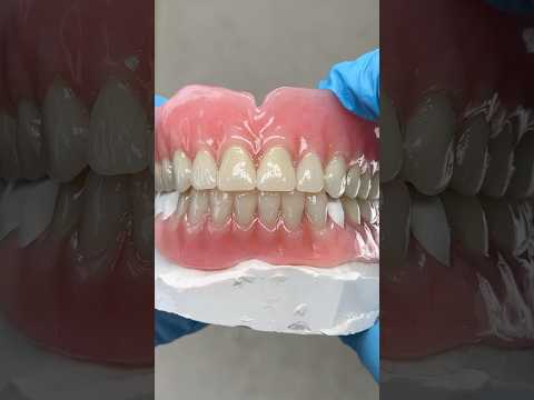 Lifelike Denture and Partial #lsk121shorts #dentist #teeth