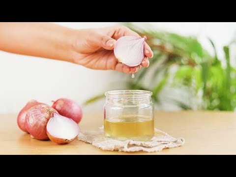 Onion Oil how to make  at home |  Benefits of onion oil | Healthy hair with onion oil