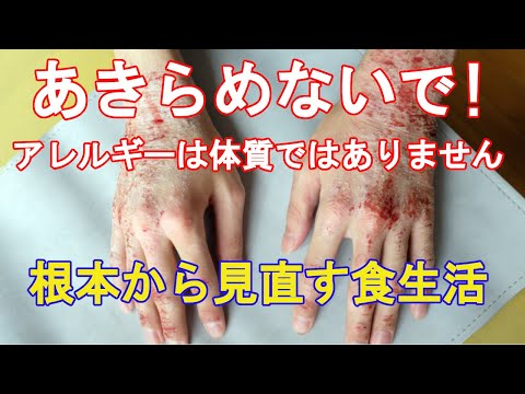 17.　アレルギーがひどくなる食事！これを排除して楽になろう。／「きっと元気になるよ！」あなたはあなたが食べた物でつくられる。