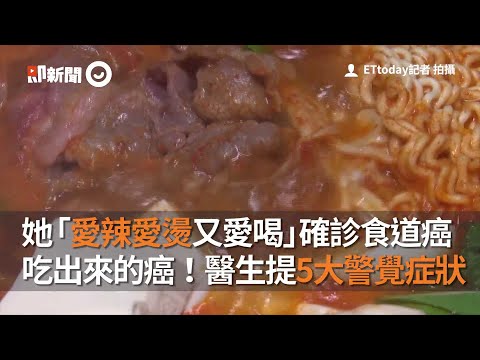 她「愛辣愛燙又愛喝」確診食道癌　吃出來的癌！醫生提5大警覺症狀