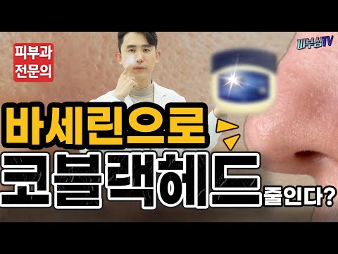 바세린으로 코 블랙헤드를 줄일수 있을까요? [피부과전문의 피부심]