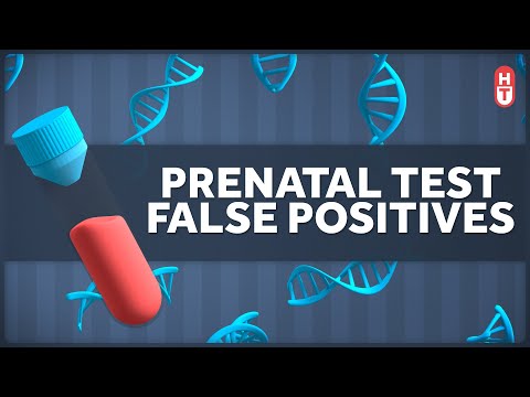 There Are Way too Many False Positives in Prenatal Screenings