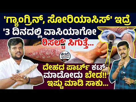 'ಗ್ಯಾಂಗ್ರಿನ್, ಸೋರಿಯಾಸಿಸ್' ಇದ್ರೆ '3 ದಿನದಲ್ಲಿ ವಾಸಿಯಾಗೋ ರಿಸಲ್ಟ್' ಸಿಗುತ್ತೆ... | Svpl Ranebennuru