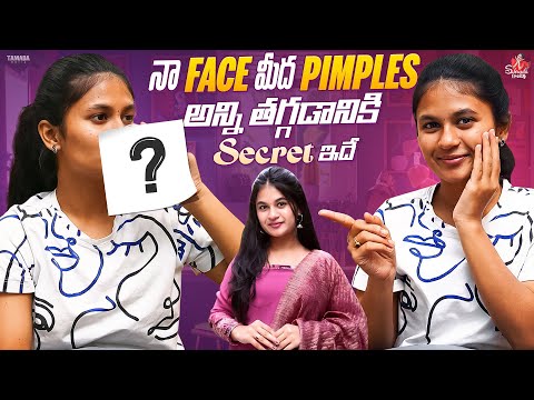 నా Face మీద Pimples అన్ని తగ్గడానికి Secret ఇదే.. || Sahrudafruity || #agaro #everydayexpert