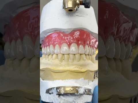 Upper Wax Try-In #lsk121shorts #dentist #teeth