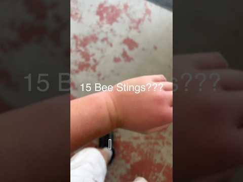 Beekeeping Injuries