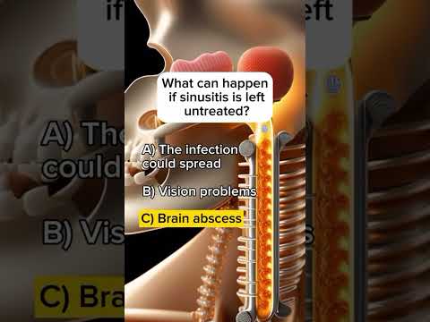 Nursing IQ Test! 💉 | How Much Do You Know?