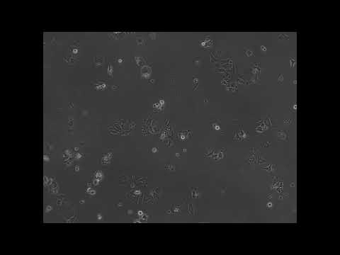 Myosin 6 in breast cancer cells – Video S8 [479151]