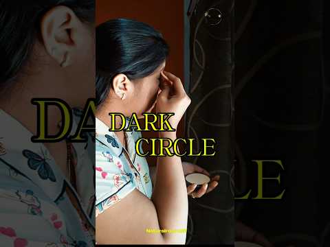 Reason behind dark circles|dark circles kyu hote hai|darkcircles is it imp to  hide|eyes care|