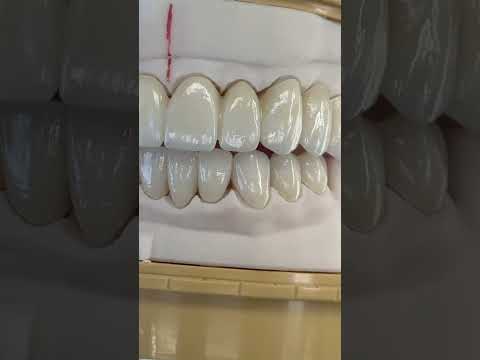 Mono Zirconia!