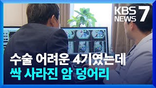 수술 어려운 4기였는데…싹 사라진 암 덩어리 / KBS  2022.10.17.