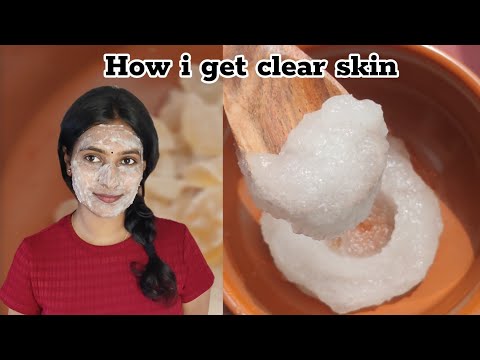 Get pimple free Skin using Almond gums/ Badam pisin❤️|Skin Brightening Face Mask at home✨