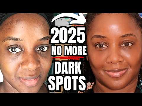 5 Ways to AVOID Dark Spots in 2025 #SkinGOALS