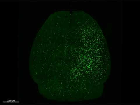 Supplementary Movie Whole Brain Imaging Acut 3D