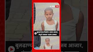 Buldhana Hair Loss Story : बुलढाण्यात अजब आजार, गावातील प्रत्येकाला तीन दिवसात पडतंय टक्कल