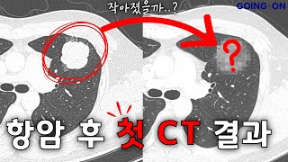 항암의 효과는 과연 있을까???? | 임상연구 | 고잉 온 크리에이터