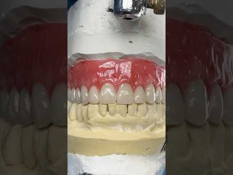 Denture Prototype #lsk121shorts #dentist #teeth