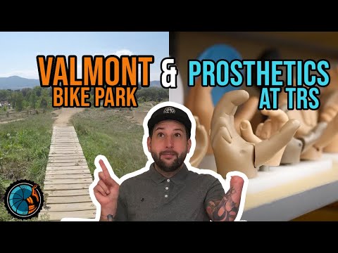 Valmont Bike Park & Visiting TRS Prosthetics in Boulder CO